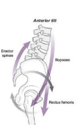 Anterior Pelvic Tilt