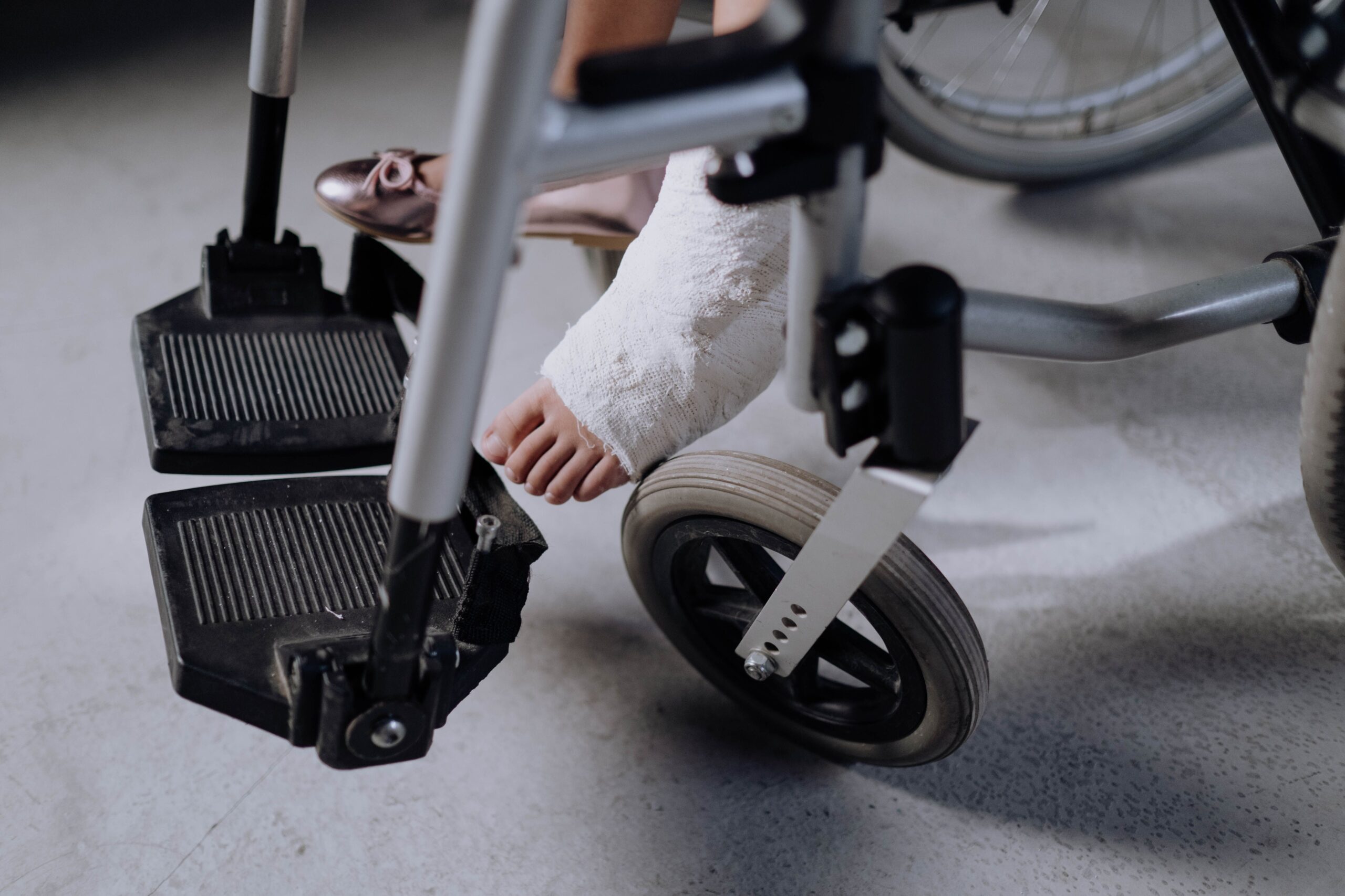 Image of a Broken Ankle